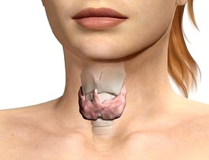 Thyroid_adenoma