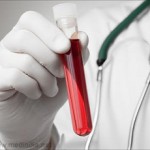 blood-test1