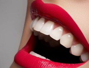 otbelivanie-zubov-naturalnymi-sredstvami-300x230