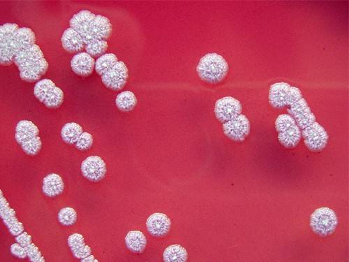 Опасный микроорганизм может убить за 24 часа