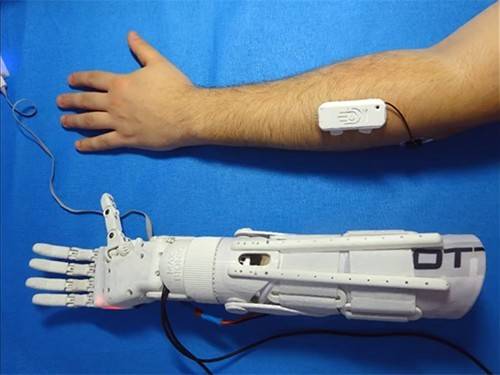 Инженер из Норильска займется производством дешевых бионических протезов