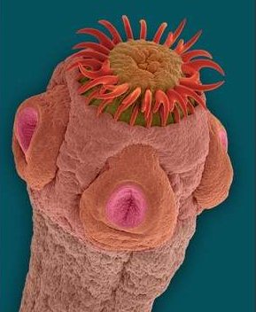 Свинной цепень - кишечний червь вызывающий заболевание тениозом