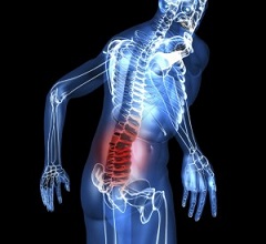 Сильная боль в спине - симптом кисты позвоночника