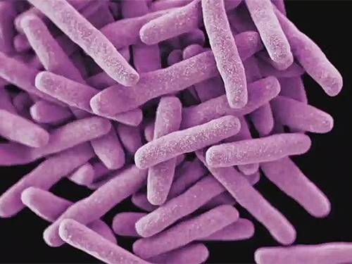 Предложен тест для быстрой диагностики туберкулеза